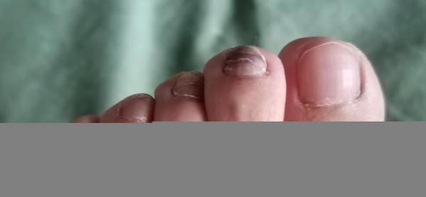 千萬不要去跑步