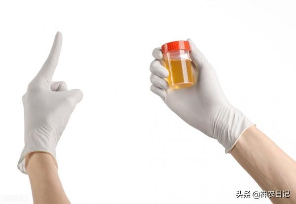 29歲男子從發現泡沫尿到尿毒症僅3年，醫生：只因忽視了這3點