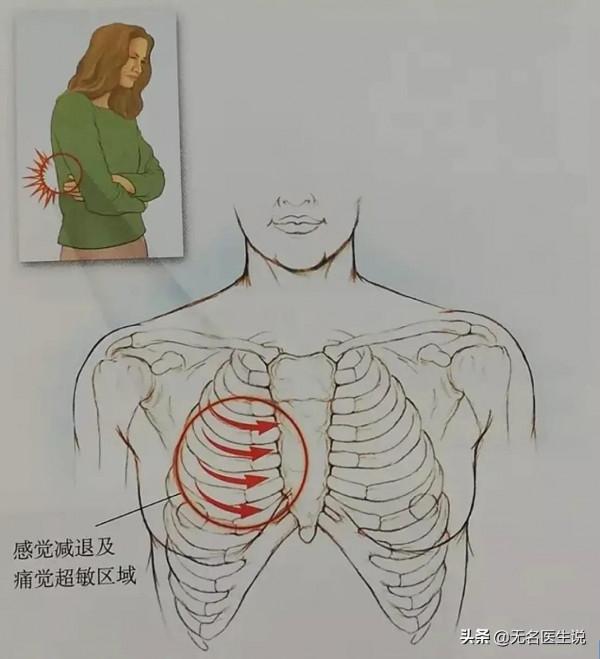 肺結節手術後對生活有哪些影響? 肺結節手術後對生活有哪些影響?