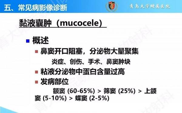頭頸五官CT斷層解剖圖及常見病影像診斷