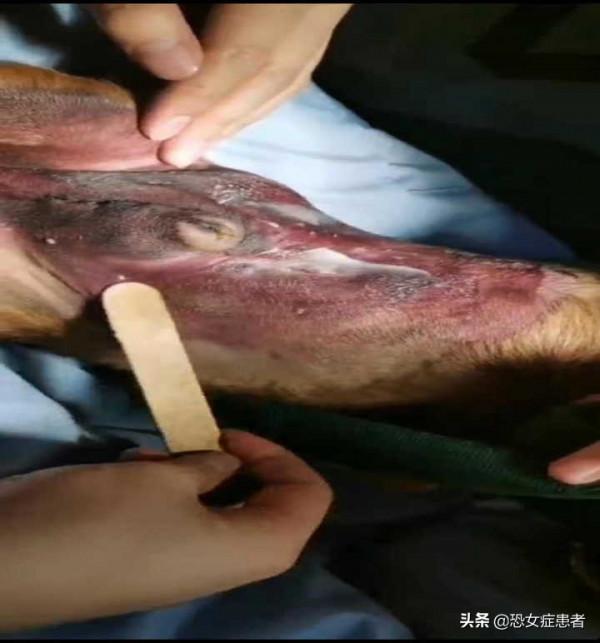 真實毒糧案例，淤血，發紺，無法站立，你不知道的毒糧症狀