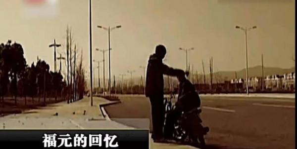 雲南32歲小夥口臭駭人，檢查發現腦中有刀片，醫生：已經四五年了