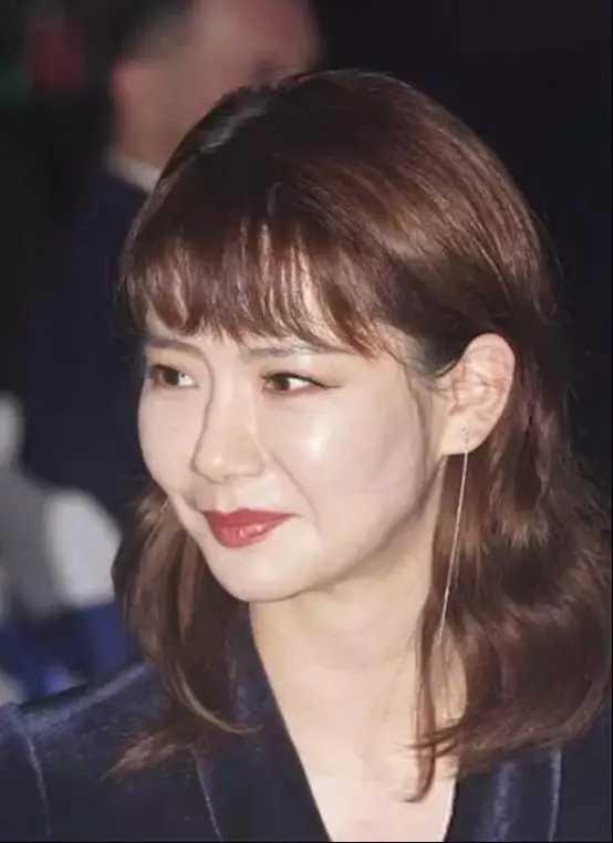 10位女星打玻尿酸前後，楊蓉、戚薇上榜，你還敢盲目“變美”嗎？