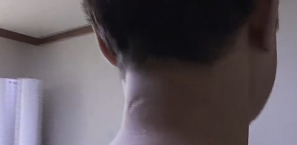 故事:韓國60歲大叔出車禍,檢查發現脖內有子彈,為何40年毫無察覺