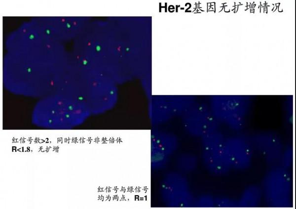 「技術分享」熒光原位雜交技術全攻略 「技術分享」熒光原位雜交技術全攻略