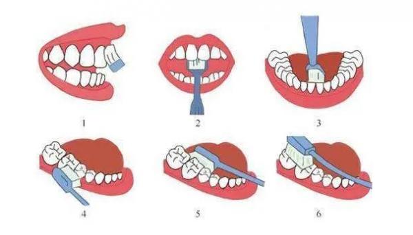 電動牙刷作為中秋禮物好不好？口腔師盤點最適合五款