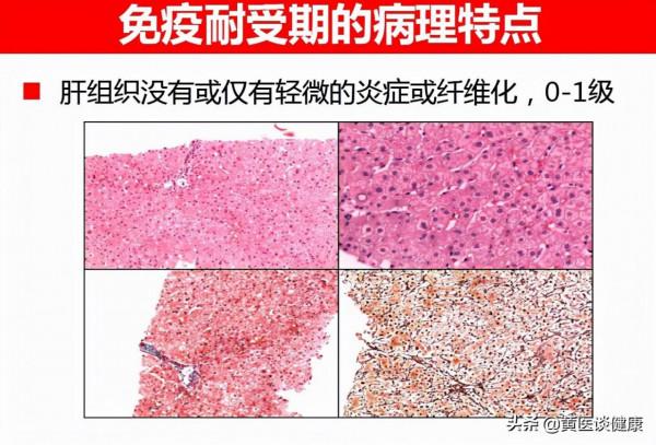 肝病醫生說乙肝暫不治療,建議繼續隨訪時,需要知道哪些方面? 肝病醫生說乙肝暫不治療,建議繼續隨訪時,需要知道哪些方面?