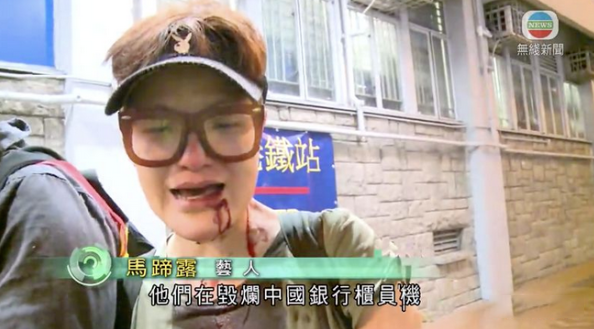 TVB“四大丑女”，兩位終生未婚，一位被打卻讓人心疼