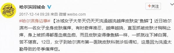 洗頭洗澡,多久洗一次最健康? 洗頭洗澡,多久洗一次最健康?