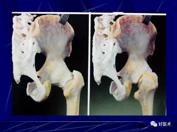 86張全身關節應用解剖精講，這篇文章值得收藏
