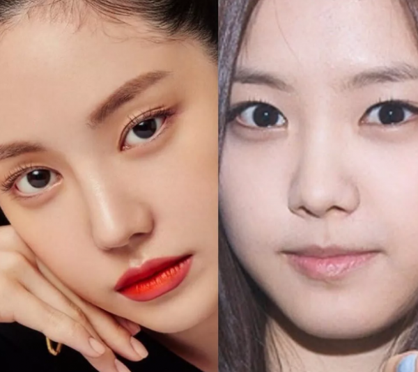 韓流明星過度整容到底有多恐怖？金喜善垮臉，蔡琳險些認不出來