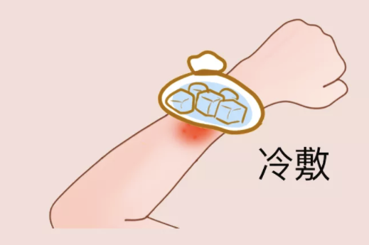 面板瘙癢千萬別撓,醫生告訴你3種緩解面板瘙癢的方法 面板瘙癢千萬別撓,醫生告訴你3種緩解面板瘙癢的方法