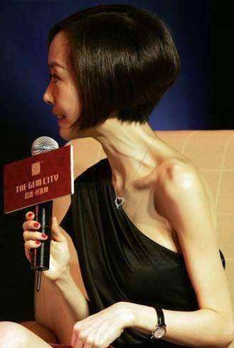 &OpenCurlyDoubleQuote;內卷&rdquo;下暴瘦的10位女星，有人瘦到22公斤，體力不支只能坐輪椅