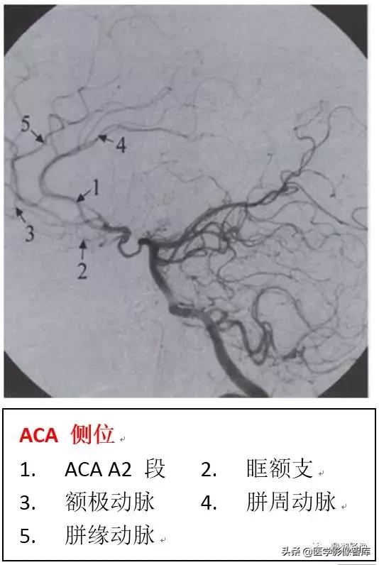 CT斷層解剖圖譜最全總結「推薦收藏」 CT斷層解剖圖譜最全總結「推薦收藏」