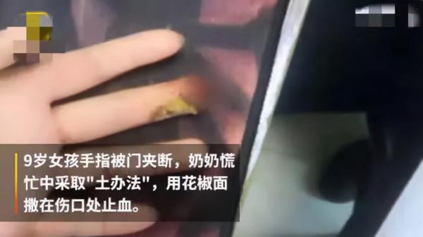 屍油敷臉、農藥洗澡、喂活蝌蚪，中國的家長們正在用偏方“謀殺”孩子