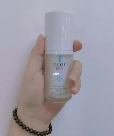 敏感肌適合什麼護膚品牌 秋冬敏感肌適合的品牌護膚品盤點