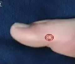 降壓手指操，排解心臟內部毒素，降壓效果非常不錯