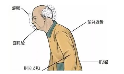 青少年長期服用抗精神病藥物會“吃壞腦子”嗎？