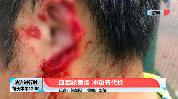 足球比賽時打傷對方球員,要承擔刑責?請看北京這個案例 足球比賽時打傷對方球員,要承擔刑責?請看北京這個案例