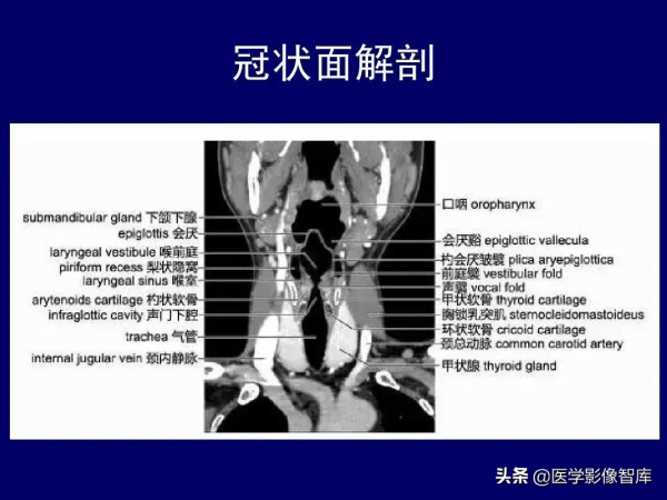 CT斷層解剖圖譜最全總結「推薦收藏」 CT斷層解剖圖譜最全總結「推薦收藏」