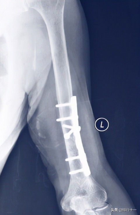 鎂基本介紹,鎂的發現歷史及產業發展,鎂的用途及應用領域 鎂基本介紹,鎂的發現歷史及產業發展,鎂的用途及應用領域