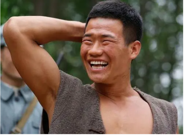 “三毛”長大了!8歲成名,14歲禿頂,34歲變帥哥,植髮挨300多針 “三毛”長大了!8歲成名,14歲禿頂,34歲變帥哥,植髮挨300多針