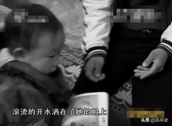 真實故事：山東女娃被開水燙成“鬼臉”，24歲結婚後又慘遭家暴