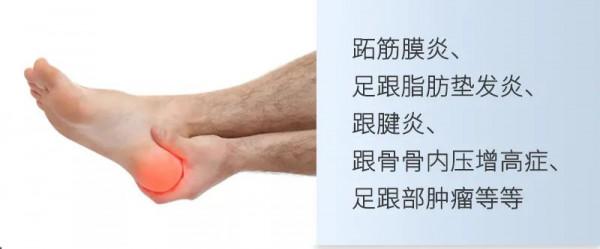 讓人飽受折磨的足跟痛是頑疾？試試這3個方法，輕鬆緩解疼痛