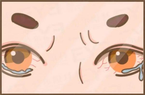 眼睛老有紅血絲,我該管嗎? 眼睛老有紅血絲,我該管嗎?