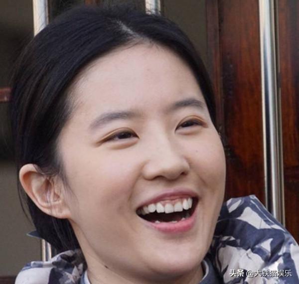 牙齒醜，也不影響成為美人的8大女星，現代人為何不能容忍瑕疵了