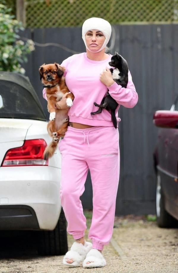 英43歲女星第五次整容被拍,頭部纏著層層繃帶,眼周瘀傷兩頰浮腫 英43歲女星第五次整容被拍,頭部纏著層層繃帶,眼周瘀傷兩頰浮腫