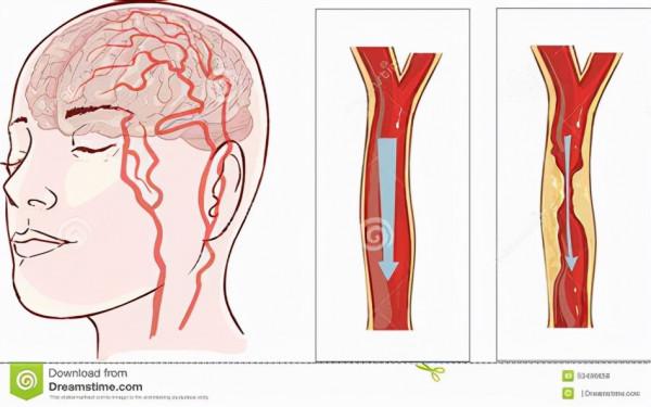 降壓藥該早上吃,還是晚上吃?據說早上7點是最佳服藥時間? 降壓藥該早上吃,還是晚上吃?據說早上7點是最佳服藥時間?