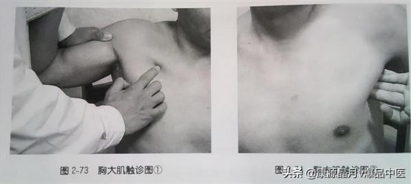 肩部疼痛的觸診圖解（很珍貴資料），值得一看