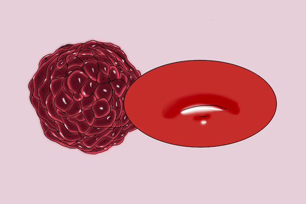 抗癌新程序:取之於癌,用之於癌!“奈米疫苗”或將到來 抗癌新程序:取之於癌,用之於癌!“奈米疫苗”或將到來