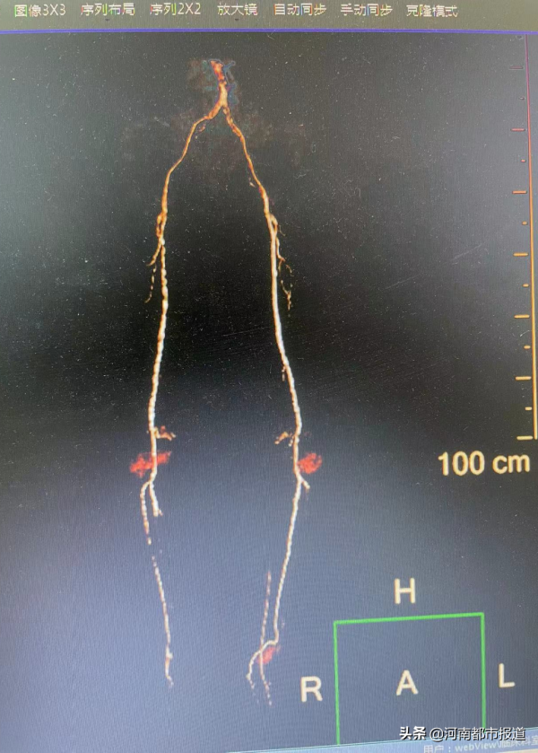 太可怕了！你還能認出這是腳嗎？