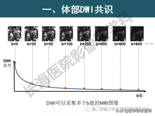 體部DWI共識及胰腺DWI研究經驗介紹