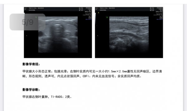 醫案分享&vert;&vert;查出乳腺結節千萬別急著做手術，予你一劑良方擊碎腫塊