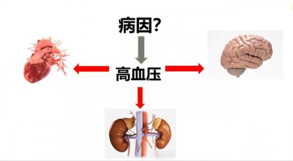 血壓低,只有一百多,甚至一百不到,是心衰了嗎?聽聽醫生怎麼說 血壓低,只有一百多,甚至一百不到,是心衰了嗎?聽聽醫生怎麼說