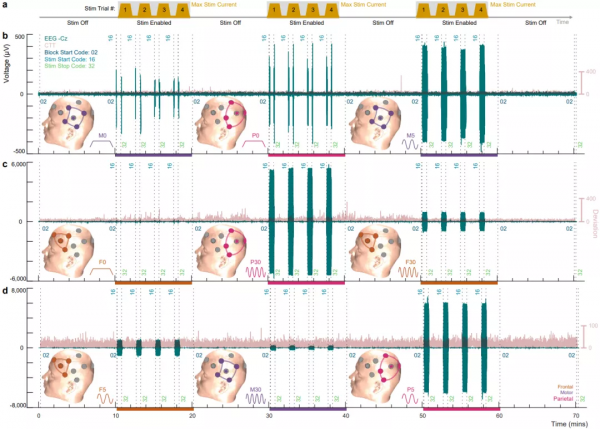 併發腦電圖、心電圖和多劑量經顱電刺激行為的資料集 併發腦電圖、心電圖和多劑量經顱電刺激行為的資料集
