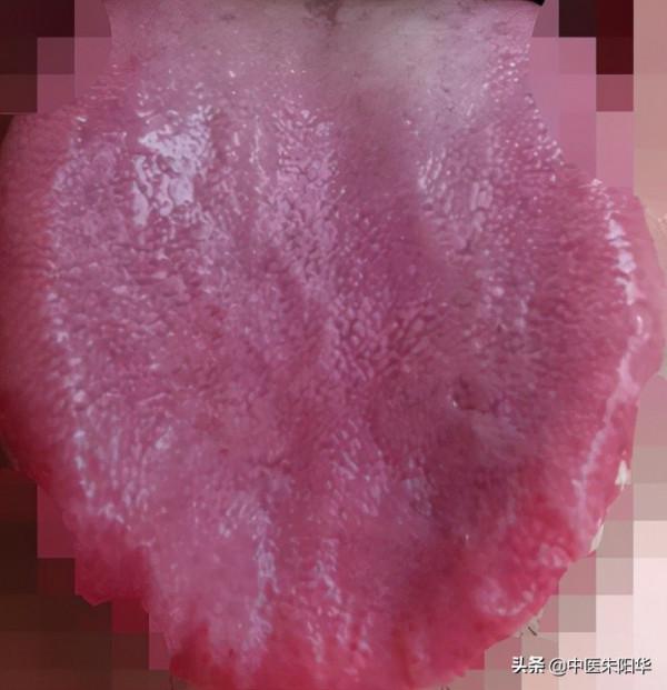 對鏡查舌早知病!中醫教您如何透過舌頭快速識別疾病 對鏡查舌早知病!中醫教您如何透過舌頭快速識別疾病