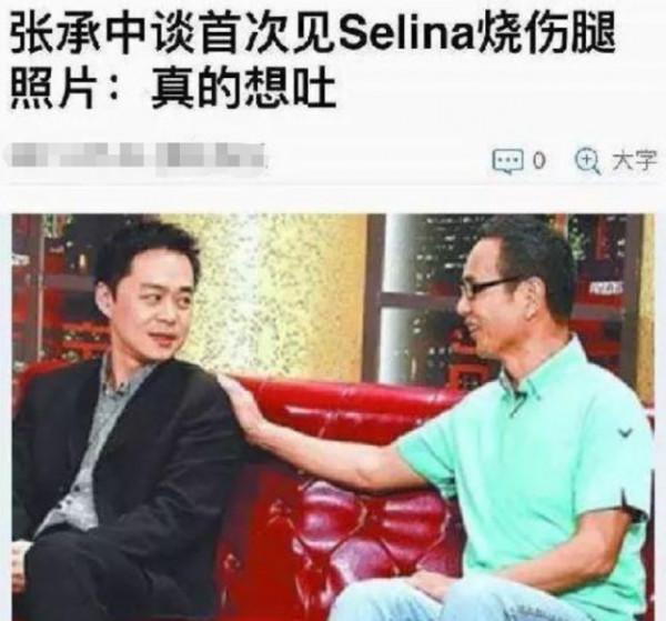 燒傷後被“暖男”拋棄，張承中直言看到Selina燒傷腿部：真的想吐
