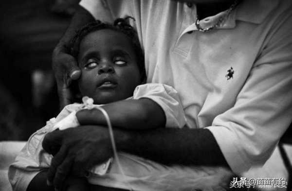 美國曆史學家威廉邁克尼爾：不起眼的病原體，決定一個王朝的興起