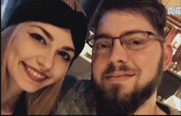 不得不承認美國醫術很強:斷了6年的雙臂,竟成功移植他人手臂 不得不承認美國醫術很強:斷了6年的雙臂,竟成功移植他人手臂