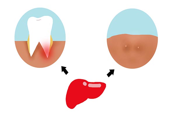 有乙肝不能吃大蒜，是真是假？乙肝患者的飲食禁忌，此文講清楚