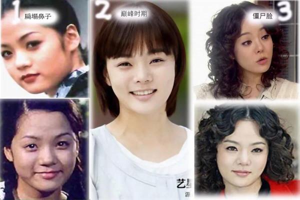 整容後遺症有多可怕?當年爆紅的初代韓流明星,現在臉都認不出 整容後遺症有多可怕?當年爆紅的初代韓流明星,現在臉都認不出