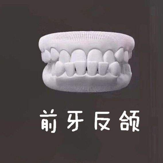 “地包天”是什麼原因導致的？哪些是我們可以做到，可以預防的？