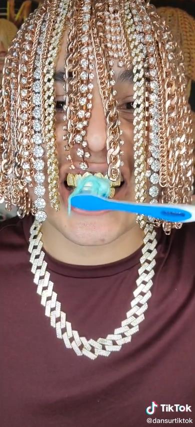 墨西哥Rapper頭皮植入數十條大金鍊，搞了一頭名副其實的金髮