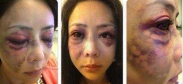 4位嫁入豪門被家暴的女明星，有的差點被毀容，有的終於找到幸福