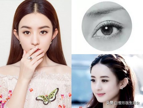 從事醫美整形工作30+年，談談我眼中的男女審美差異？