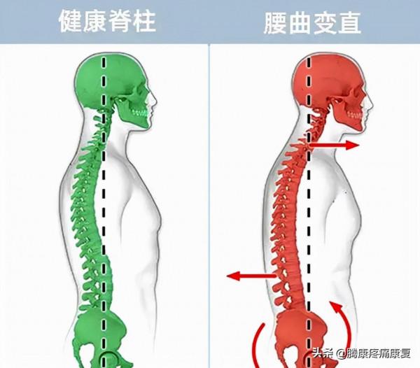 關於這七個引起背痛的姿勢,可能你每天都在做 關於這七個引起背痛的姿勢,可能你每天都在做